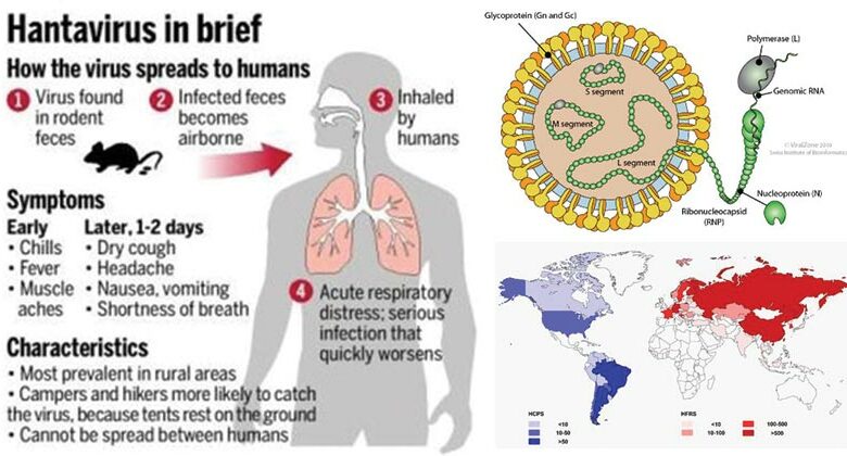 Hanta-Virus