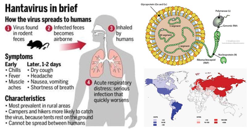 Hantavirus Explain for UPSC